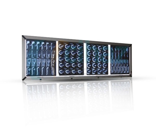 Elektromag PEGA-4 Dörtlü LCD Negatoskop